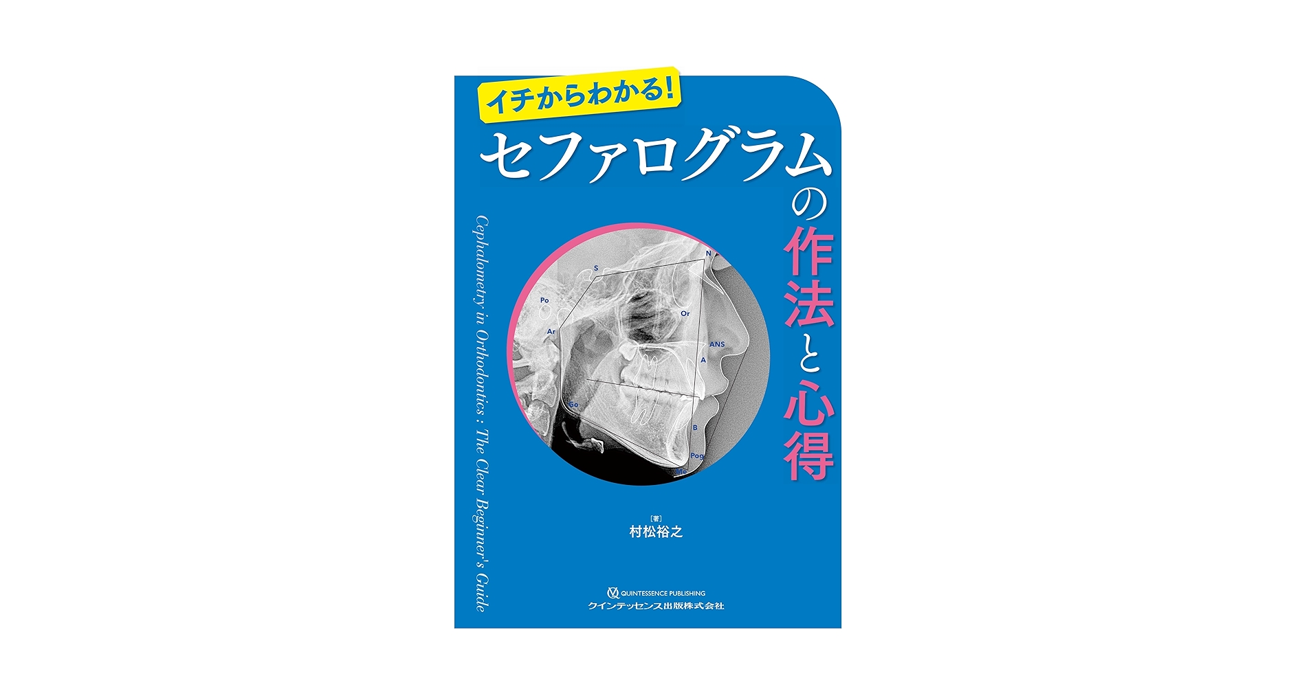 【裁断済】イチからわかる！　セファログラムの作法と心得 セファログラムの作法と心得: イチからわかる! | 村松裕之 |本 | 通販